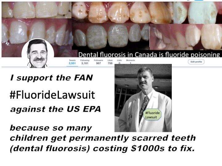 Fluoride Hardy Limeback.jpeg