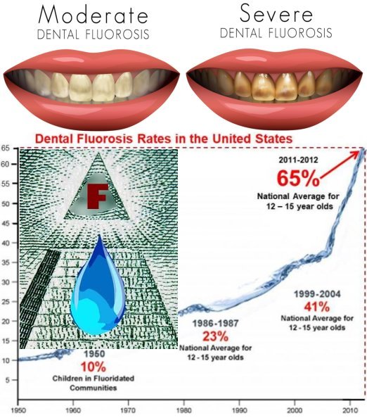 Fluoride.jpg