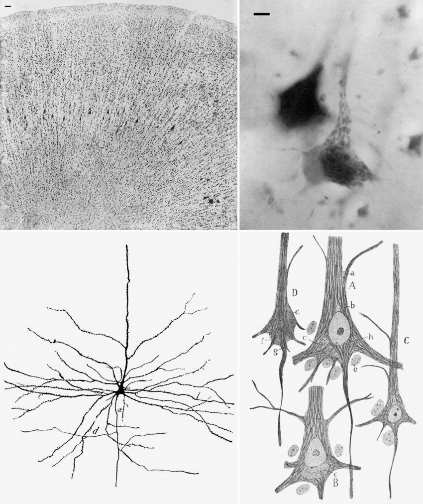 pyramidal cells of Betz.jpg